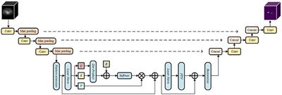 SW-UNet: a U-Net fusing sliding window transformer block with CNN for segmentation of lung nodules